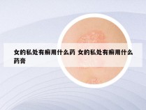 女的私处有癣用什么药 女的私处有癣用什么药膏