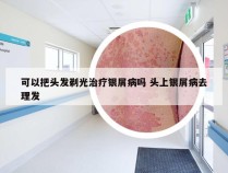 可以把头发剃光治疗银屑病吗 头上银屑病去理发
