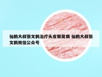 仙鹤大叔张文鹤治疗头皮银屑病 仙鹤大叔张文鹤微信公众号