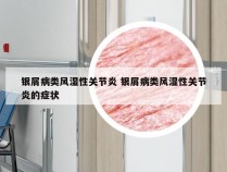 银屑病类风湿性关节炎 银屑病类风湿性关节炎的症状