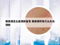 银屑病怎么能预防复发 银屑病可有什么办法预防