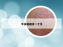 牛皮癣跑步一个月