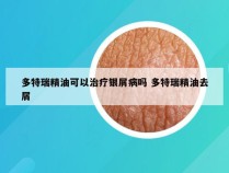 多特瑞精油可以治疗银屑病吗 多特瑞精油去屑