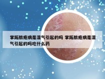 掌跖脓疱病是湿气引起的吗 掌跖脓疱病是湿气引起的吗吃什么药