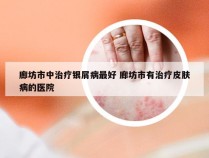 廊坊市中治疗银屑病最好 廊坊市有治疗皮肤病的医院