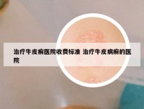 治疗牛皮癣医院收费标准 治疗牛皮病癣的医院