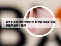 长春的皮肤病医院哪家好 长春最权威的皮肤病医院是哪个医院