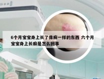 6个月宝宝身上长了像癣一样的东西 六个月宝宝身上长癣是怎么回事