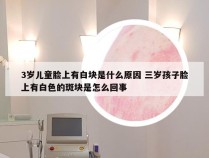 3岁儿童脸上有白块是什么原因 三岁孩子脸上有白色的斑块是怎么回事