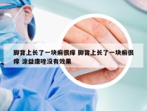 脚背上长了一块癣很痒 脚背上长了一块癣很痒 涂益康唑没有效果