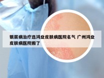 银屑病治疗选鸿业皮肤病医院名气 广州鸿业皮肤病医院搬了