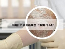 长癣什么药膏最理想 长癣用什么好