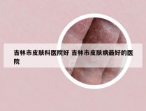 吉林市皮肤科医院好 吉林市皮肤病最好的医院