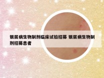 银屑病生物制剂临床试验招募 银屑病生物制剂招募患者