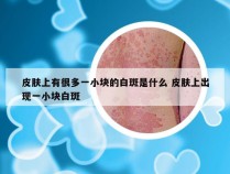 皮肤上有很多一小块的白斑是什么 皮肤上出现一小块白斑