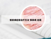 银屑病经络治疗方法 银屑病 经络