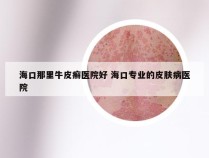 海口那里牛皮癣医院好 海口专业的皮肤病医院