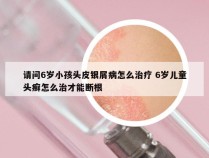 请问6岁小孩头皮银屑病怎么治疗 6岁儿童头癣怎么治才能断根