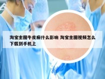 淘宝主图牛皮癣什么影响 淘宝主图视频怎么下载到手机上