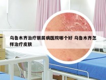 乌鲁木齐治疗银屑病医院哪个好 乌鲁木齐怎样治疗皮肤