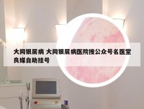 大同银屑病 大同银屑病医院搜公众号名医堂良媒自助挂号