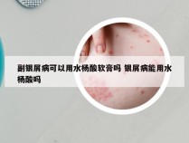 副银屑病可以用水杨酸软膏吗 银屑病能用水杨酸吗