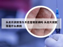 头皮片状脱落久不愈是银屑病吗 头皮片状脱落是什么原因