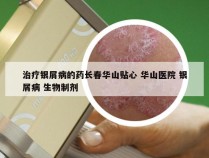 治疗银屑病的药长春华山贴心 华山医院 银屑病 生物制剂