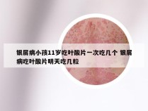 银屑病小孩11岁吃叶酸片一次吃几个 银屑病吃叶酸片明天吃几粒