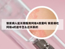 银屑病人能长期服用阿维A胶囊吗 银屑病吃阿维a的途中怎么还长新的
