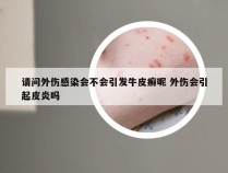 请问外伤感染会不会引发牛皮癣呢 外伤会引起皮炎吗