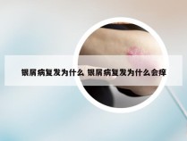 银屑病复发为什么 银屑病复发为什么会痒