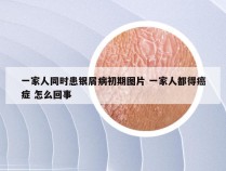 一家人同时患银屑病初期图片 一家人都得癌症 怎么回事