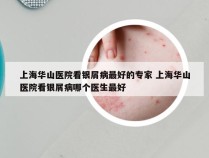 上海华山医院看银屑病最好的专家 上海华山医院看银屑病哪个医生最好