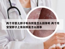 两个月婴儿脖子有白斑是怎么回事呢 两个月宝宝脖子上有白斑是怎么回事