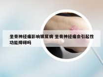 坐骨神经痛影响银屑病 坐骨神经痛会引起性功能障碍吗