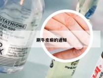 刷牛皮癣的通知