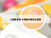 小孩脸长癣 小孩脸长癣怎么回事