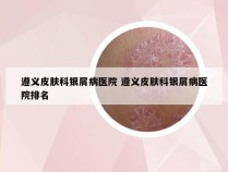 遵义皮肤科银屑病医院 遵义皮肤科银屑病医院排名
