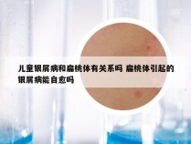 儿童银屑病和扁桃体有关系吗 扁桃体引起的银屑病能自愈吗