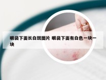 眼袋下面长白斑图片 眼袋下面有白色一块一块