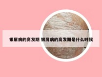 银屑病的高发期 银屑病的高发期是什么时候