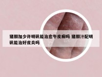猪胆加少许明矾能治愈牛皮癣吗 猪胆汁配明矾能治好皮炎吗