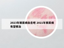 2023年银屑病自愈吧 2021年银屑病有望根治