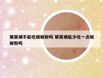 银屑病不能吃胡椒粉吗 银屑病能少吃一点胡椒粉吗