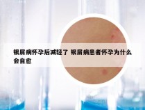 银屑病怀孕后减轻了 银屑病患者怀孕为什么会自愈