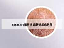 xtrac308银屑病 最新银屑病新药