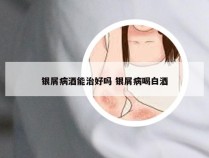 银屑病酒能治好吗 银屑病喝白酒