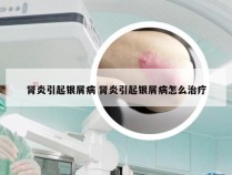 肾炎引起银屑病 肾炎引起银屑病怎么治疗