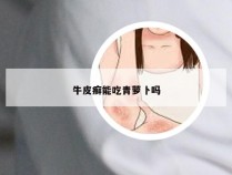 牛皮癣能吃青萝卜吗
